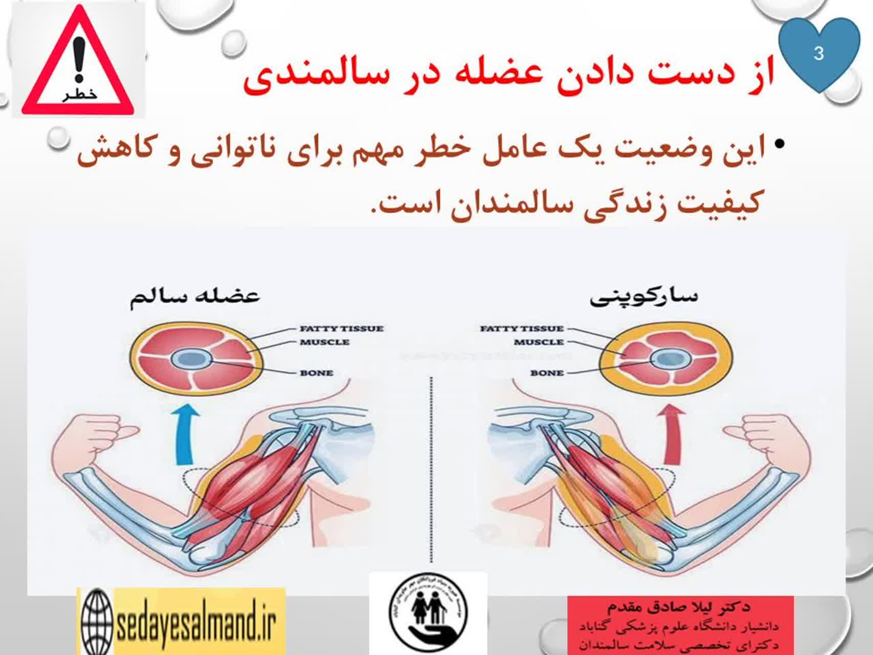 سارکوپنیا3